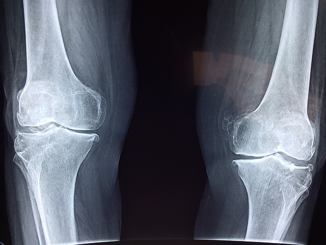 rentgen poškozeného kolene